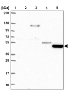 Lane 1: Marker [kDa] 250, 130, 95, 72, 55, 36, 28, 17, 10_br/_Lane 2: Human cell line RT-4_br/_Lane 3: Human cell line U-251 MG_br/_Lane 4: Human plasma_br/_Lane 5: Human Liver tissue