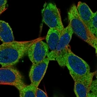Immunofluorescent staining of human cell line SH-SY5Y shows localization to plasma membrane, cytosol & vesicles.