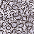Immunohistochemical staining of human colon shows strong nuclear positivity in glandular cells and lymphoid cells.