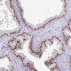 Anti-UBE2Q1 Antibody