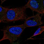 Immunofluorescent staining of human cell line SH-SY5Y shows localization to centrosome.