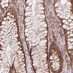 Immunohistochemical staining of human rectum shows strong cytoplasmic positivity in glandular cells.