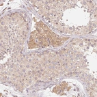 Immunohistochemical staining of human testis shows weak cytoplasmic positivity in Leydig cells.