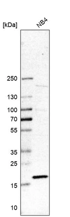 Western blot analysis in human cell line NB4.