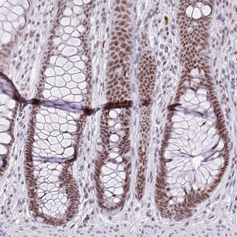 Anti-ZNF860 Antibody