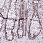 Anti-ZNF860 Antibody