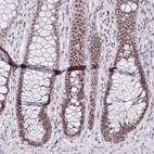 Anti-ZNF860 Antibody