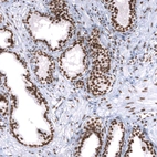 Immunohistochemical staining of human prostate shows strong nuclear positivity in glandular cells.