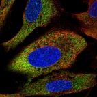 Immunofluorescent staining of human cell line U-2 OS shows localization to cytosol & endoplasmic reticulum.