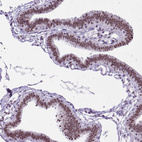 Immunohistochemical staining of human fallopian tube shows strong nuclear positivity in glandular cells.