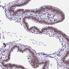 Immunohistochemical staining of human fallopian tube shows strong nuclear positivity in glandular cells.