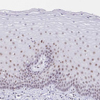 Immunohistochemical staining of human cervix, uterine shows weak nucleoli positivity in squamous epithelial cells.