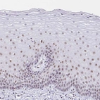 Immunohistochemical staining of human cervix, uterine shows weak nucleoli positivity in squamous epithelial cells.
