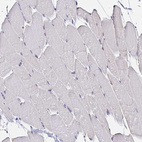Immunohistochemical staining of human skeletal muscle shows no positivity in myocytes as expected.
