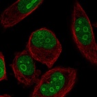 Immunofluorescent staining of human cell line PC-3 shows localization to nucleus & nucleoli.