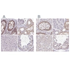 Anti-RSL24D1 Antibody