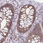 Immunohistochemical staining of human colon using Anti-RSL24D1 antibody HPA063392.