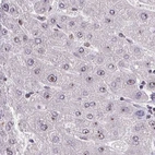 Immunohistochemical staining of human liver using Anti-RSL24D1 antibody HPA063392.