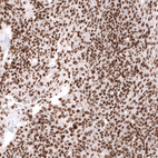 Anti-SMARCB1 Antibody