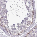 Immunohistochemical staining of human testis using Anti-RSL24D1 antibody HPA063392.