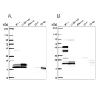 Western blot analysis using Anti-RSL24D1 antibody HPA063392 (A) shows similar pattern to independent antibody HPA062724 (B).