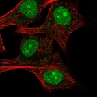 Immunofluorescent staining of human cell line SK-MEL-30 shows localization to nucleus & nucleoli.