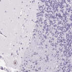 Anti-ST8SIA3 Antibody