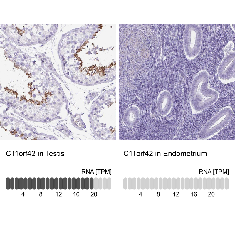 Anti-C11orf42 Antibody