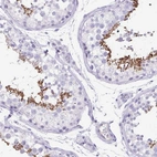 Immunohistochemical staining of human testis shows high expression.