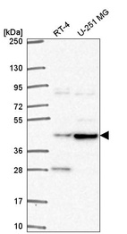 Anti-TEPSIN Antibody