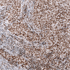 Anti-SMARCB1 Antibody