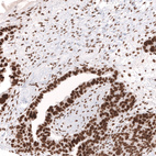 Anti-SMARCB1 Antibody