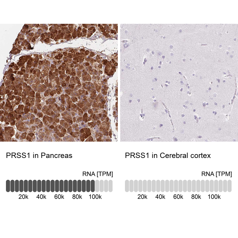 Anti-PRSS1 Antibody