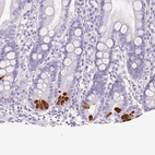 Immunohistochemical staining of human duodenum shows strong cytoplasmic positivity in Paneth cells.