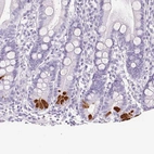 Immunohistochemical staining of human duodenum shows strong cytoplasmic positivity in Paneth cells.