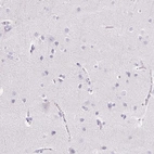 Immunohistochemical staining of human cerebral cortex shows no positivity in neuronal cells as expected.