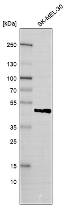 Western blot analysis in human cell line SK-MEL-30.