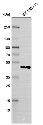 Western blot analysis in human cell line SK-MEL-30.