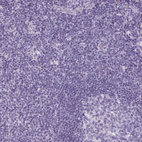 Immunohistochemical staining of human tonsil shows no positivity in non-germinal center cells as expected.