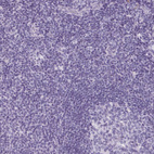 Anti-PRSS1 Antibody