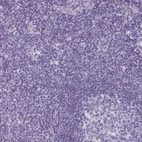 Immunohistochemical staining of human tonsil shows no positivity in non-germinal center cells as expected.