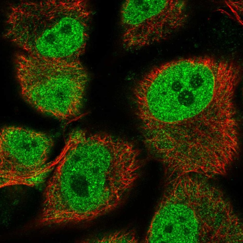 Anti-HEY1 Antibody