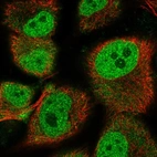 Anti-HEY1 Antibody