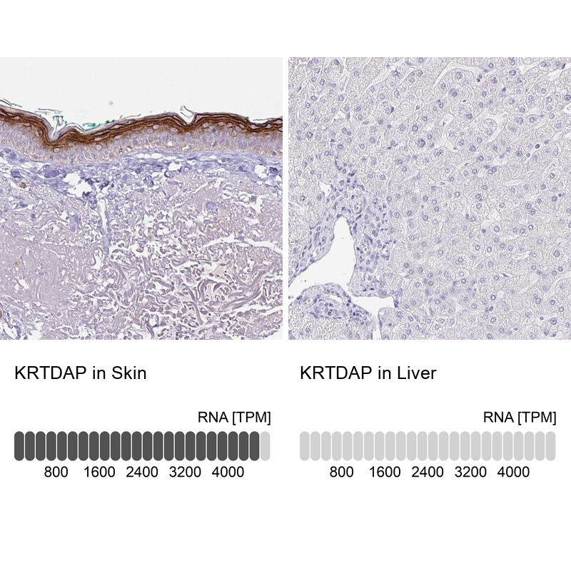 Anti-KRTDAP Antibody