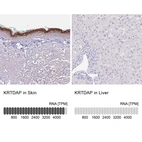 Anti-KRTDAP Antibody