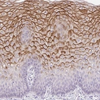 Immunohistochemical staining of human cervix shows strong cytoplasmic and membrnaous immunoreactivity in squamous epithelial cells.
