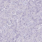 Immunohistochemical staining of human pancreas shows no positivity in exocrine glandular cells as expected.