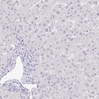 Immunohistochemical staining of human liver shows no positivity in hepatocytes as expected.