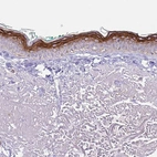 Immunohistochemical staining of human skin shows strong cytoplasmic and membranous positivity in keratonocytes.