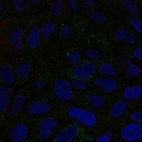 Anti-CMTM6 Antibody